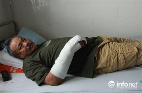 Đắk Lắk : Kinh hoàng tên trộm đâm chủ nhà 7 nhát chí mạng rồi tẩu thoát - Ảnh 2.