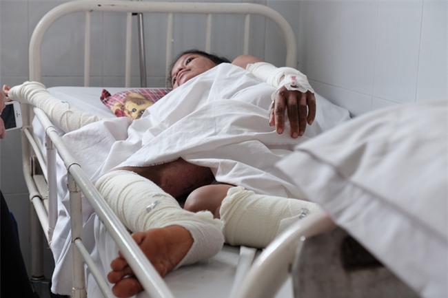 Nến rớt xuống bình xăng dưới giường, hai mẹ con thai phụ bỏng nặng, chồng chưa cưới ôm tiền ủng hộ bỏ trốn - Ảnh 9.