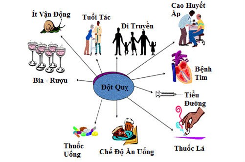 đột quỵ,tai biến mạch máu não