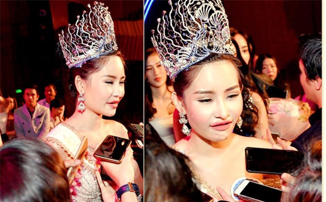Tân Hoa hậu Đại dương 2017 thừa nhận từng phẫu thuật thẩm mỹ