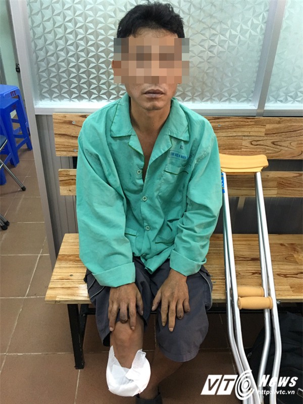 Hut thuoc la suot 25 nam, nguoi dan ong phai cat chan, thao khop tay hinh anh 1