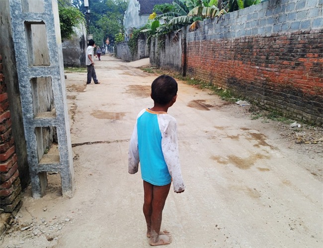 Hà Nội: Tận cùng nỗi đau, sự khốn khổ của một gia đình có nhiều người tâm thần - Ảnh 9.