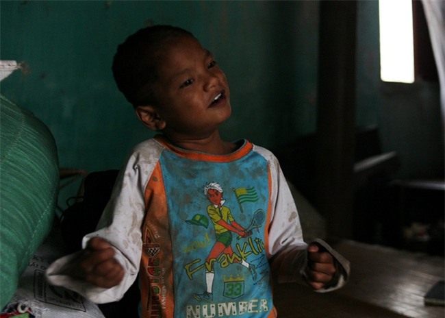 Hà Nội: Tận cùng nỗi đau, sự khốn khổ của một gia đình có nhiều người tâm thần - Ảnh 10.