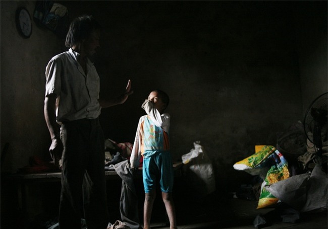 Hà Nội: Tận cùng nỗi đau, sự khốn khổ của một gia đình có nhiều người tâm thần - Ảnh 7.