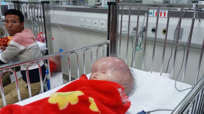 Người mẹ bị tố không đồng ý đưa con bị não úng thủy sang Singapore chữa trị lên tiếng