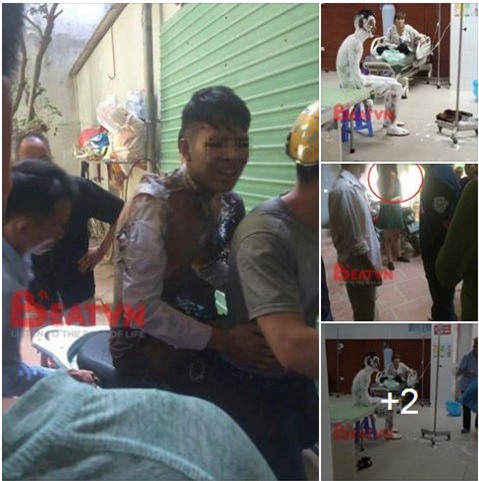 Bắc Ninh: Nam thanh niên tẩm xăng tự thiêu, nghi do cãi nhau với bạn gái