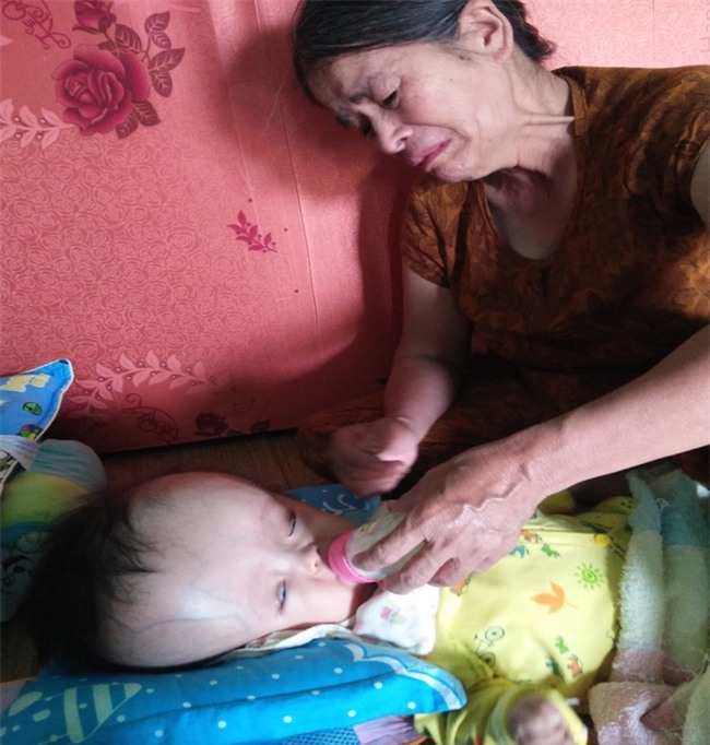 Cuộc sống đau đớn của bé gái 8 tháng tuổi mồ côi cha, cái đầu như muốn nổ tung vì căn bệnh não úng thủy