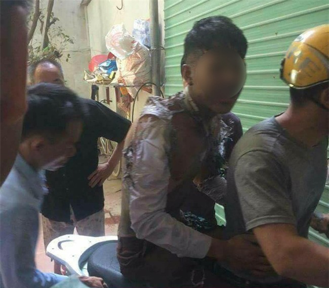 Vụ nam thanh niên bỏng toàn thân: Tẩm xăng tự thiêu do người yêu đòi chia tay - Ảnh 1.