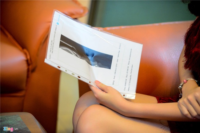 Nhan sac gay tranh cai cua Tan Hoa hau Dai duong giua doi thuong hinh anh 7