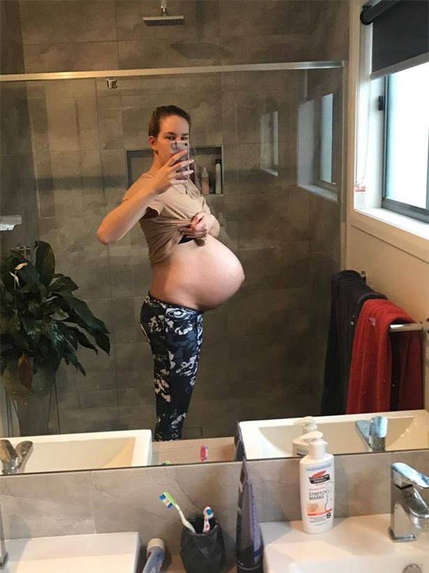 sat ngay sinh, me bau hot hoang khi mot buoi sang tinh giac bong mat bi liet mot nua - 2