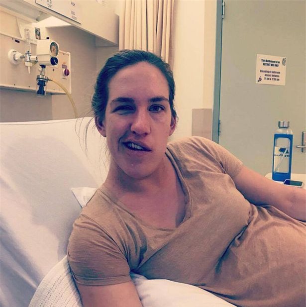 sat ngay sinh, me bau hot hoang khi mot buoi sang tinh giac bong mat bi liet mot nua - 3