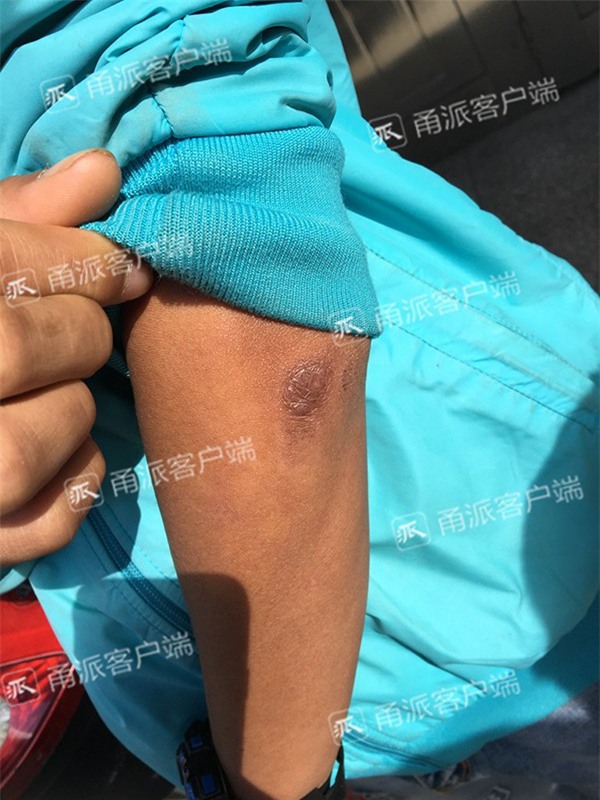 Bố mẹ đẻ nhẫn tâm bắt con làm “bình phong” cho xe đâm tới gãy tay, chấn thương sọ não để vòi tiền - Ảnh 1.