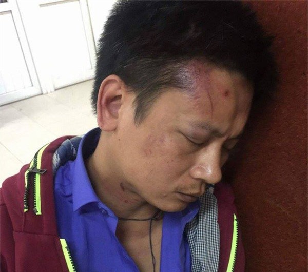 dua nguoi nha den bv phu san ha noi cap cuu, nguoi dan ong bi 3 bao ve hanh hung - 1