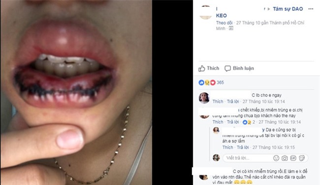 Bien chung nguy hiem khi phau thuat tao hinh moi hinh anh 1