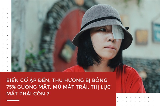 Nu sinh bi tat axit o Sai Gon: Tinh yeu chot den khi doi tam toi nhat! hinh anh 1