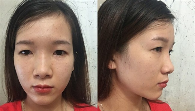 Bị cả nhà người yêu xua đuổi, bạn bè chê mắt lươn, đuổi việc vì nhìn gian manh, cô gái lột xác ngoạn mục - Ảnh 3.