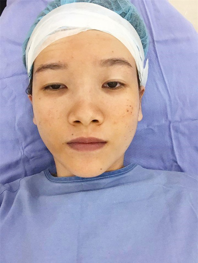 Bị cả nhà người yêu xua đuổi, bạn bè chê mắt lươn, đuổi việc vì nhìn gian manh, cô gái lột xác ngoạn mục - Ảnh 5.