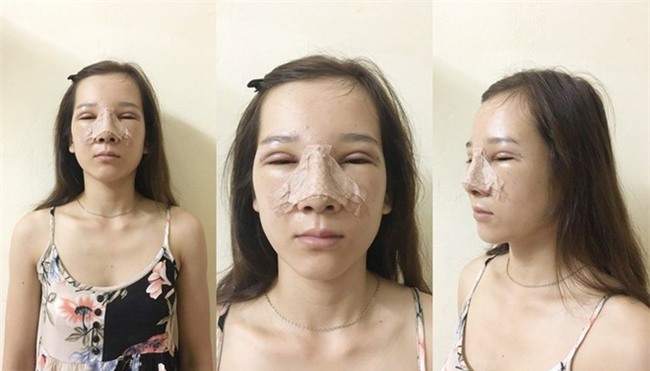 Bị cả nhà người yêu xua đuổi, bạn bè chê mắt lươn, đuổi việc vì nhìn gian manh, cô gái lột xác ngoạn mục - Ảnh 7.