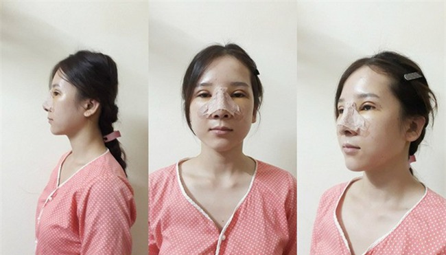 Bị cả nhà người yêu xua đuổi, bạn bè chê mắt lươn, đuổi việc vì nhìn gian manh, cô gái lột xác ngoạn mục - Ảnh 8.