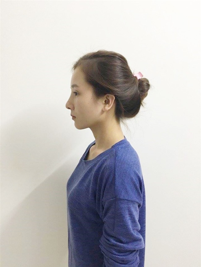 Bị cả nhà người yêu xua đuổi, bạn bè chê mắt lươn, đuổi việc vì nhìn gian manh, cô gái lột xác ngoạn mục - Ảnh 9.