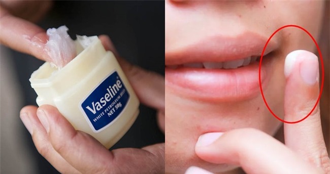 Moi 'nut toac', kho ne co nao, cu boi thu nay len la mem mai chi sau 1 dem