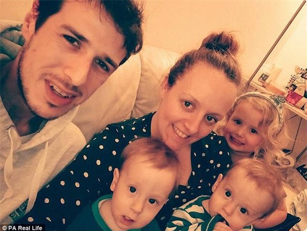 thai ky gap nguy hiem, hai be song sinh thoat chet nho om nhau trong bung me - 1