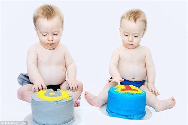 thai ky gap nguy hiem, hai be song sinh thoat chet nho om nhau trong bung me - 9