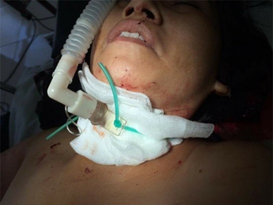 Nam thiếu niên cứa cổ chủ tiệm tóc vì hiếp dâm không thành - Ảnh 1.