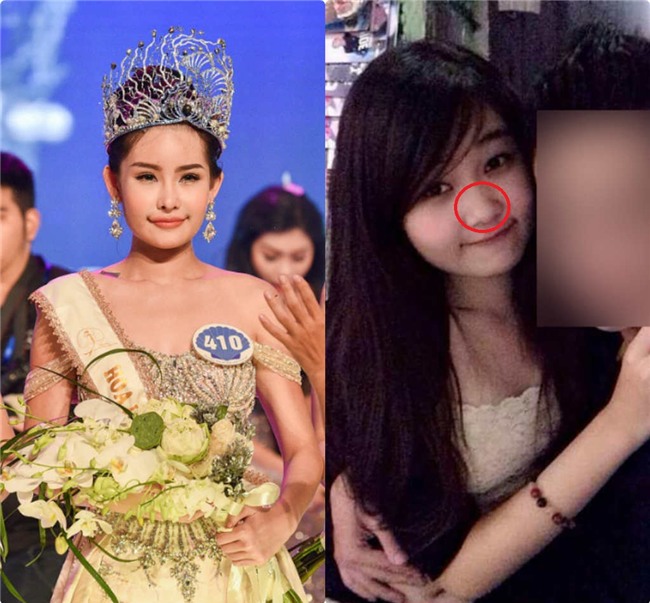 Choáng vì gương mặt tròn lạ, mũi tẹt của Hoa hậu Đại dương 2017