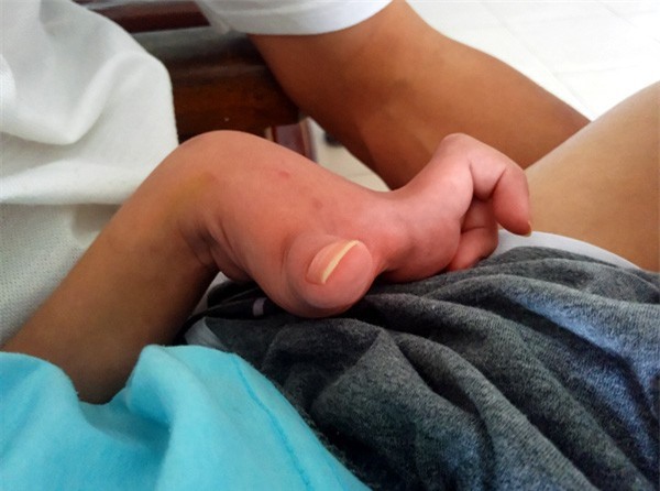 Sau trận sốt cao, bé trai khỏe mạnh thành người tàn phế, bố mẹ khốn khó vì gia cảnh ngặt nghèo - Ảnh 5.