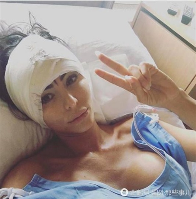 Cuồng cái đẹp, cô gái trẻ chi hơn 6 tỷ đồng thẩm mỹ để biến mình thành búp bê Barbie - Ảnh 3.