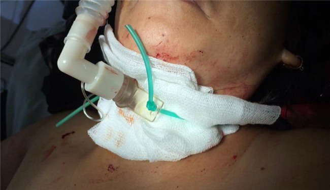 Vụ bà chủ tiệm tóc bị cắt cổ: Gây án xong, nghi phạm bình thản đi nghe ngóng