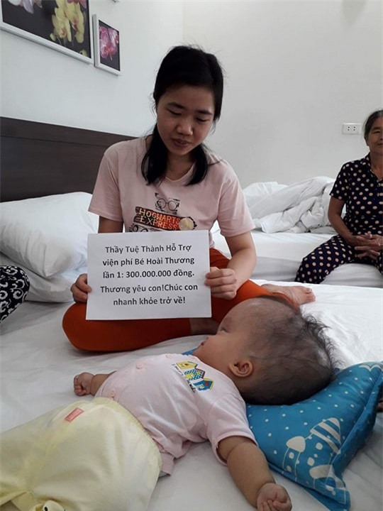 Đã quyên góp được gần 500 triệu đồng chuẩn bị cho ngày mai đưa bé gái đầu to đi Singapore chữa bệnh - Ảnh 1.