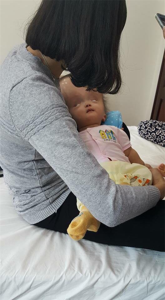 Đã quyên góp được gần 500 triệu đồng chuẩn bị cho ngày mai đưa bé gái đầu to đi Singapore chữa bệnh - Ảnh 4.