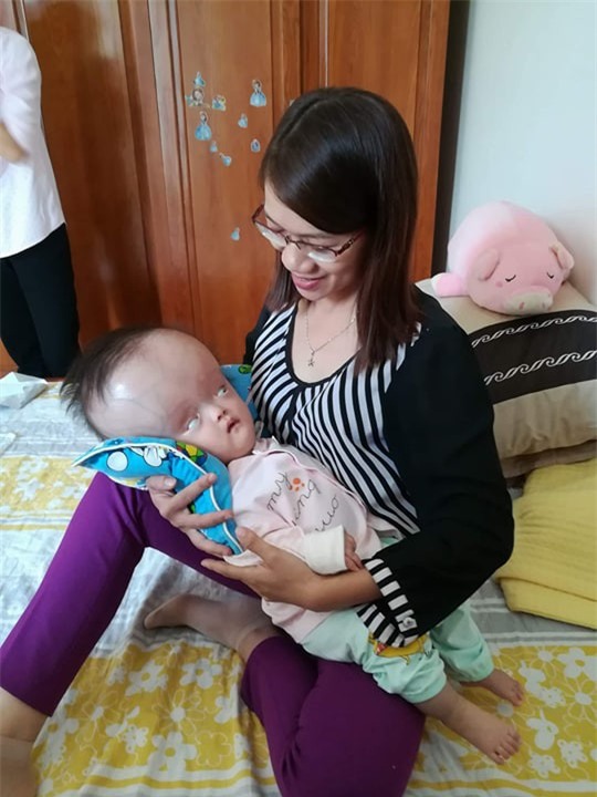 Đã quyên góp được gần 500 triệu đồng chuẩn bị cho ngày mai đưa bé gái đầu to đi Singapore chữa bệnh - Ảnh 5.