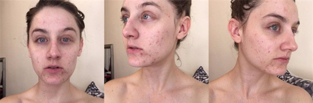 Cắt bỏ một thứ duy nhất trong quy trình chăm sóc da, cô gái nhận lại kết quả mỹ mãn không thể ngờ - Ảnh 1.