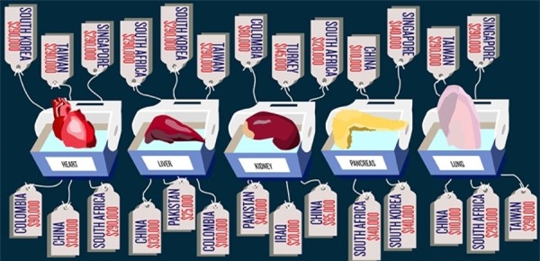 Theo chân phóng viên Reuters đi tìm sự thật đằng sau những công ty buôn nội tạng người tại Mỹ - Ảnh 3.