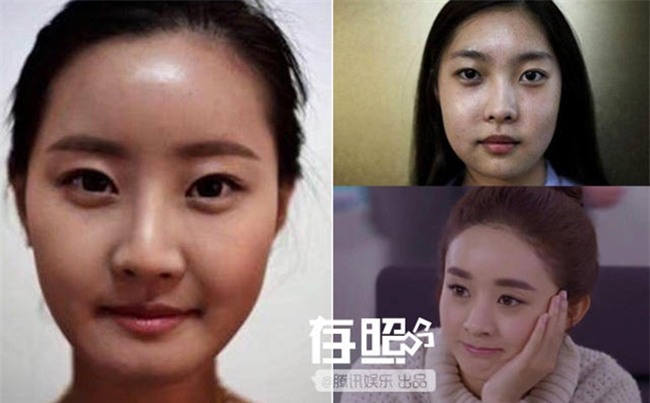 Thời buổi bây giờ đã hâm mộ cuồng nhiệt là phải phẫu thuật thẩm mỹ cho xinh đẹp giống thần tượng cơ! - Ảnh 6.