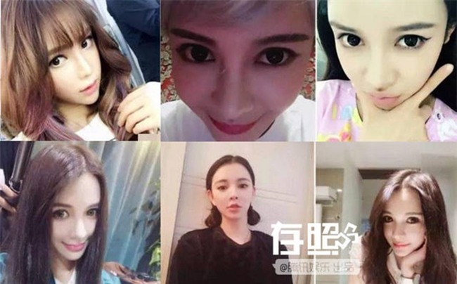 Thời buổi bây giờ đã hâm mộ cuồng nhiệt là phải phẫu thuật thẩm mỹ cho xinh đẹp giống thần tượng cơ! - Ảnh 7.