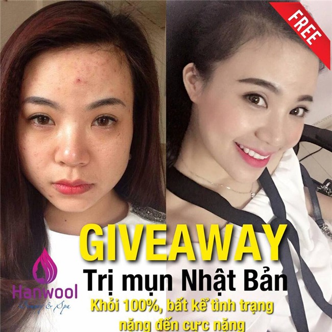 ba chu lo my pham 11 ty du do 