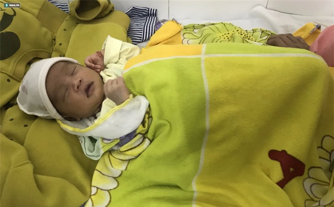 Nhỏ sữa chữa đau mắt, mẹ chết lặng vì con thủng giác mạc, nổi bong bóng mắt