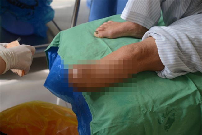 Can benh dang am tham de doa tinh mang hon 400 trieu nguoi hinh anh 1