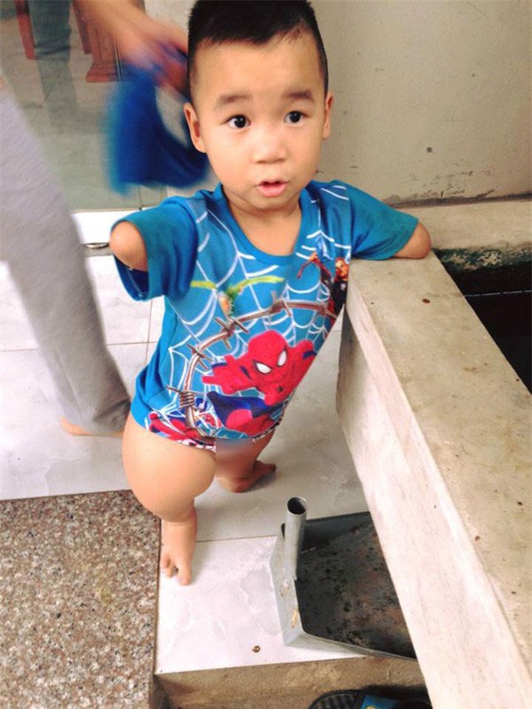 Cảm phục cô bé Sọ Dừa xinh xắn, cụt hai chân vẫn tung tăng đến lớp