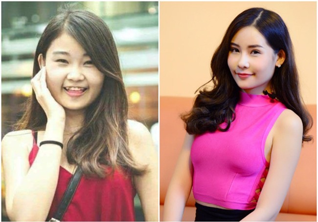 'Hoa hau Dai duong tung sua mui thi khong con la ve dep tu nhien' hinh anh 1