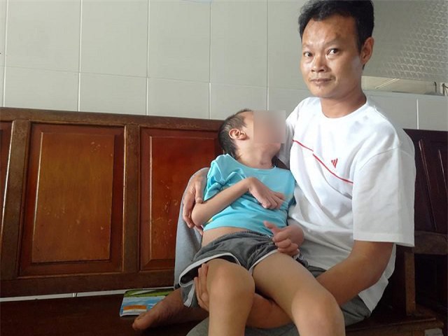 chu quan voi con sot cao co giat, be trai 7 tuoi phai song doi thuc vat - 1