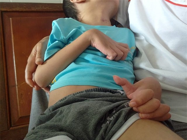 chu quan voi con sot cao co giat, be trai 7 tuoi phai song doi thuc vat - 2