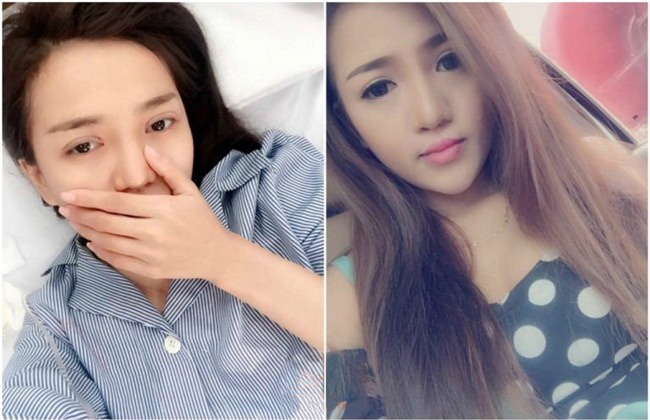 phau thuat tham my thanh cong, co gai tre hanh phuc sau bao nam "khong muon soi guong" - 2