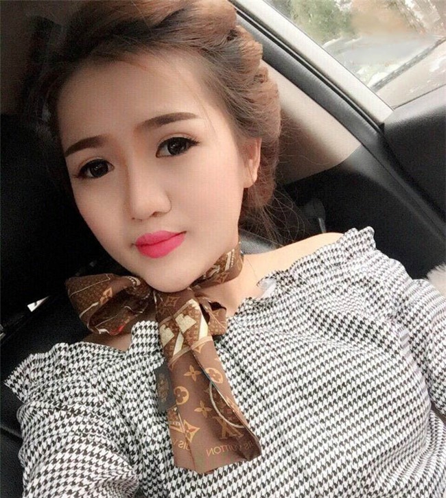 phau thuat tham my thanh cong, co gai tre hanh phuc sau bao nam "khong muon soi guong" - 5