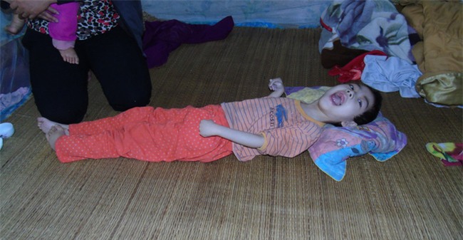 Mỗi ngày buộc phải cho con uống 12 viên thuốc ngủ, người mẹ đau đớn chứng kiến con ngày càng héo úa - Ảnh 1.