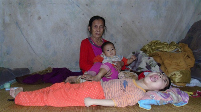 Mỗi ngày buộc phải cho con uống 12 viên thuốc ngủ, người mẹ đau đớn chứng kiến con ngày càng héo úa - Ảnh 2.